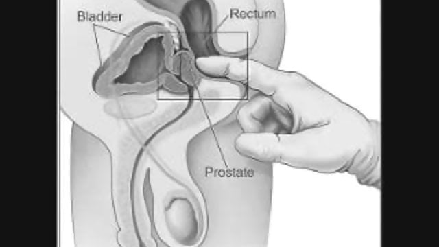 Cadillac reccomend anal prostate instructions