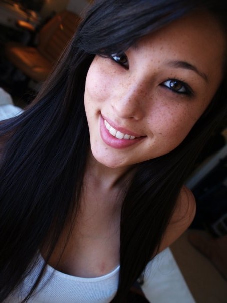 Freckles asian
